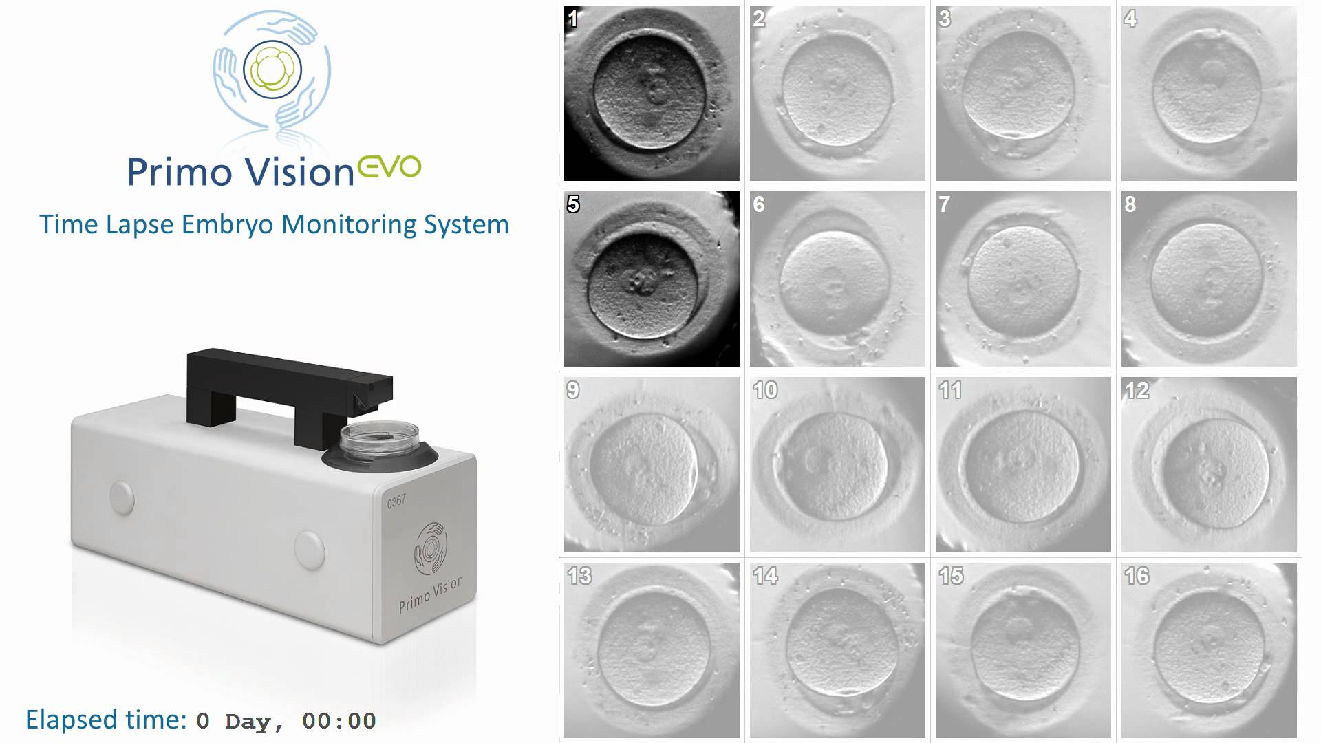 primovisionevo